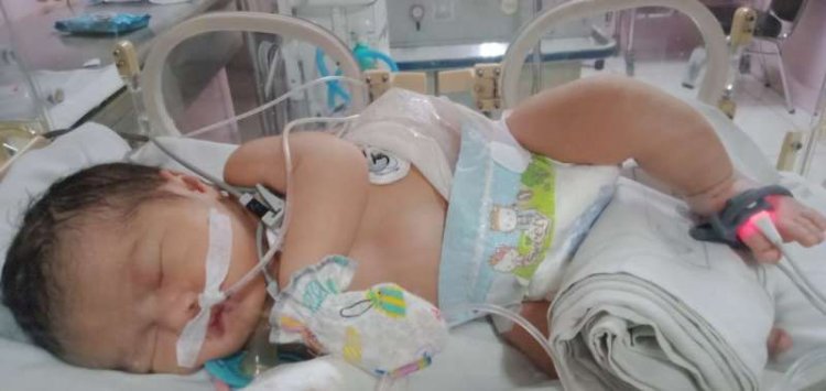 Bantu Ia Sembuh: Malaikat Kecil itu Bernama Kirana, Terlahir dengan Kelainan Tanpa Lubang Anus